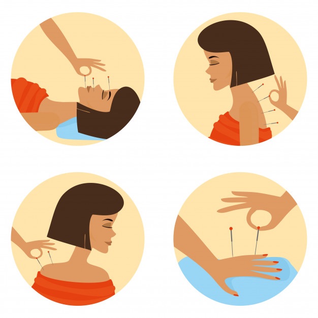 11 Benefits of Acupuncture Treatment