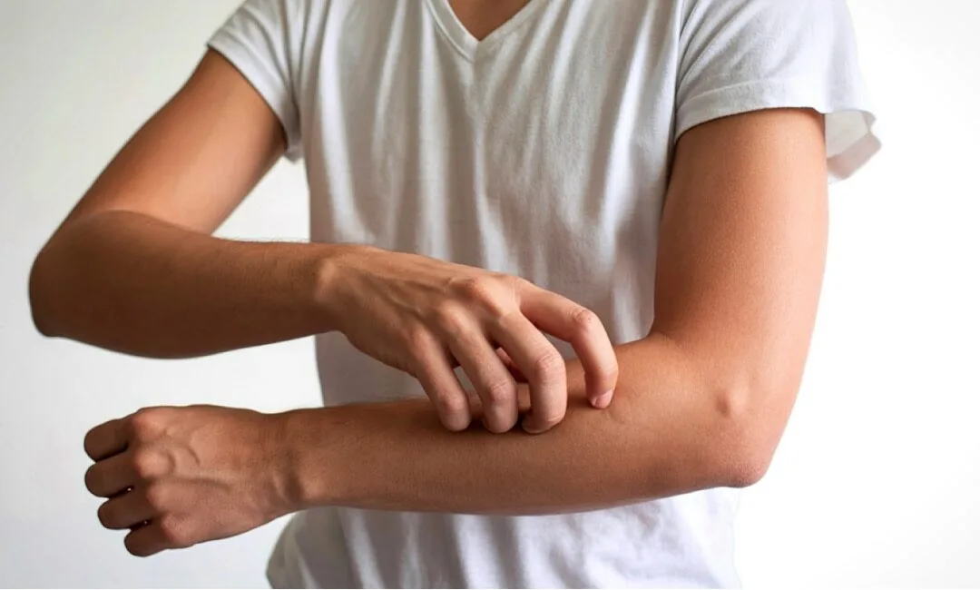 Stop the Itch: How Acupuncture Helps Eczema, Psoriasis, Hives & Chronic Itchy Skin in Greater Boston